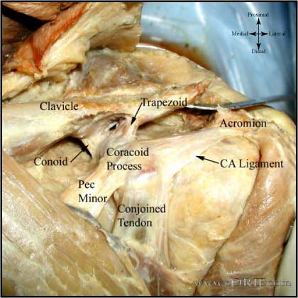 Distal clavicle ligaments