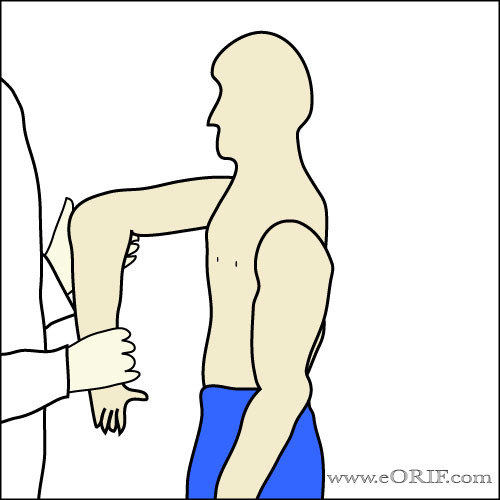 coracoid impingment sign 