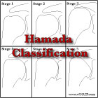 hamada classification