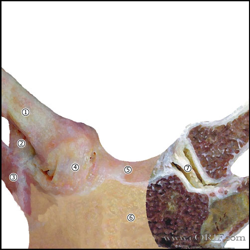 Condensing Osteitis picture
