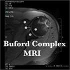 Buford complex MRI