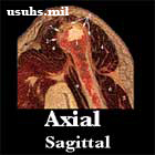 Anatomy Oblique Sagittal