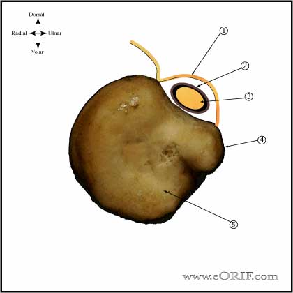 extensor carpi ulnaris subsheath extensor carpi ulnaris image