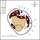 Elbow Cross Sectional Anatomy Elbow Cross Sectional Anatomy