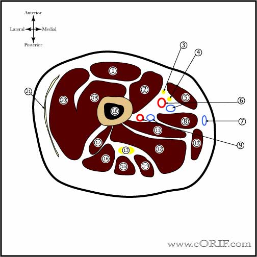 Thigh cross section Thigh Cross sectional anatomy image