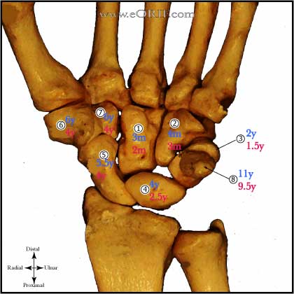 Carpal Ossification Sequence Carpal Ossification Sequence