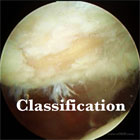 Chondromalacia Classification image