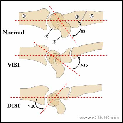 DISI image DISI and VISI image