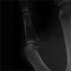 Gamekeepers thumb xray Gamekeepers Xray