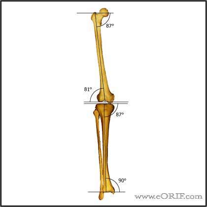 knee alignment limb alignment