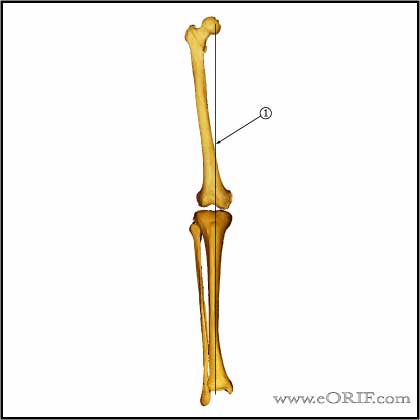  Mechanical axis of Lower extremity 