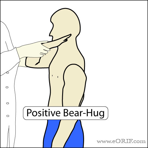 Bear Hug Test