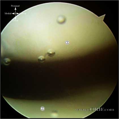 Normal Articular Cartilage picture