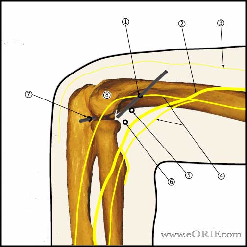 elbow arthroscopy medial portals